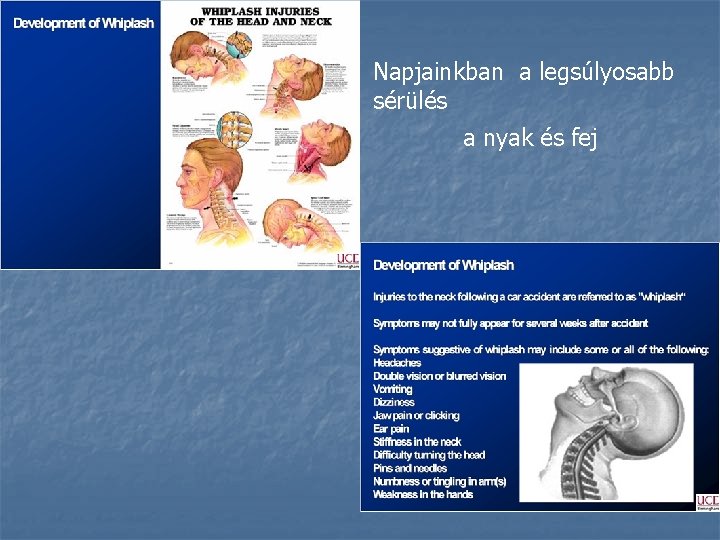 Napjainkban a legsúlyosabb sérülés a nyak és fej 