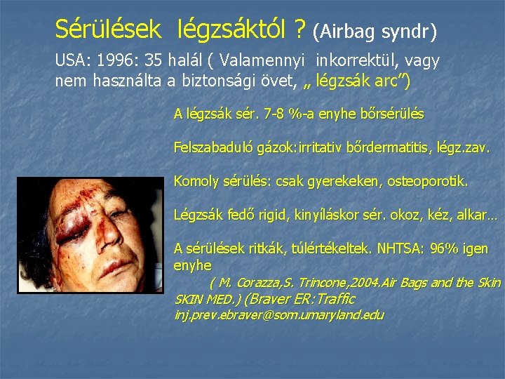 Sérülések légzsáktól ? (Airbag syndr) USA: 1996: 35 halál ( Valamennyi inkorrektül, vagy nem