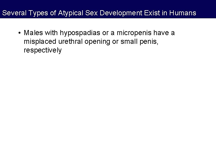 Several Types of Atypical Sex Development Exist in Humans • Males with hypospadias or