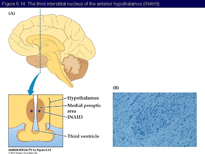 Figure 6. 14 The third interstitial nucleus of the anterior hypothalamus (INAH 3) 