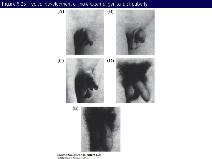 Figure 6. 23 Typical development of male external genitalia at puberty 