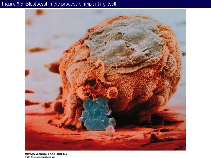 Figure 6. 5 Blastocyst in the process of implanting itself 