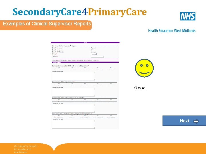 Secondary. Care 4 Primary. Care Examples of Clinical Supervisor Reports Good Next Developing people