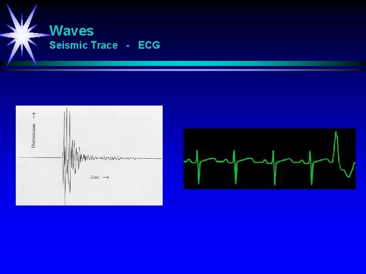 Waves Seismic Trace - ECG 