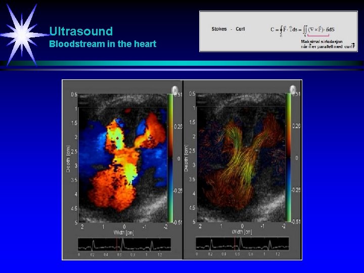 Ultrasound Bloodstream in the heart 