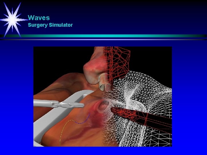 Waves Surgery Simulator 