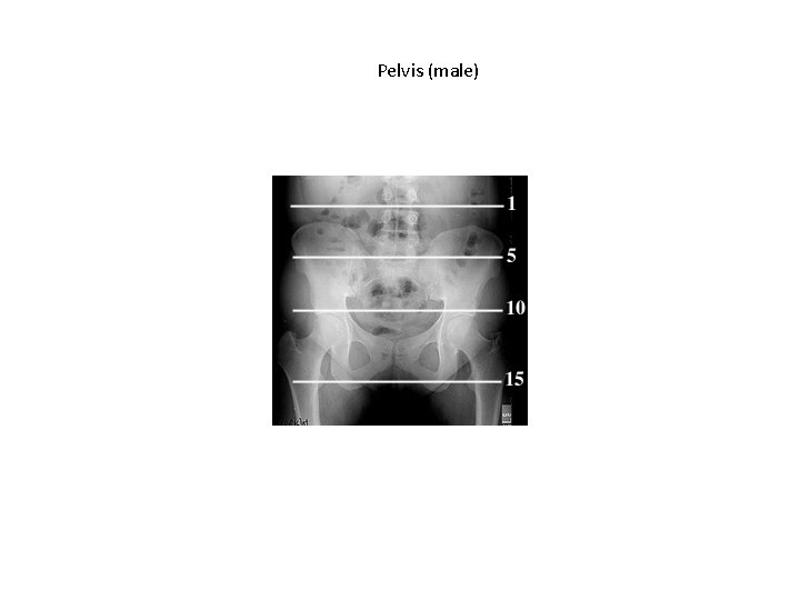Pelvis (male) Pelvis (male)