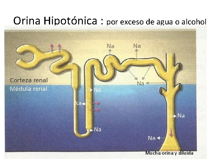 Orina Hipotónica : por exceso de agua o alcohol Mucha orina y diluída 