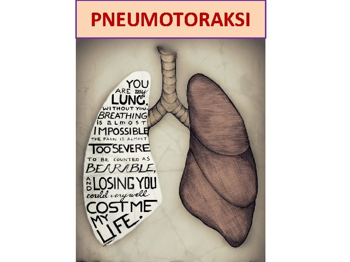 PNEUMOTORAKSI 