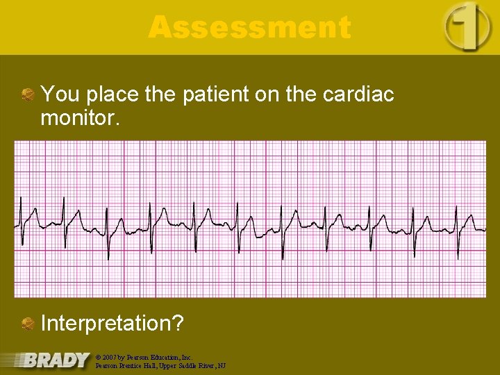 Assessment You place the patient on the cardiac monitor. Interpretation? © 2007 by Pearson