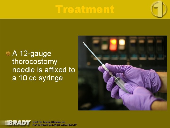 Treatment A 12 -gauge thorocostomy needle is affixed to a 10 cc syringe ©