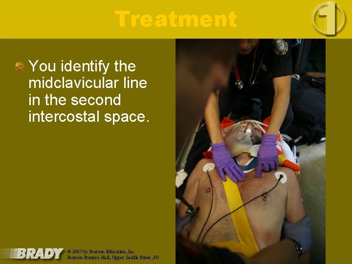 Treatment You identify the midclavicular line in the second intercostal space. © 2007 by