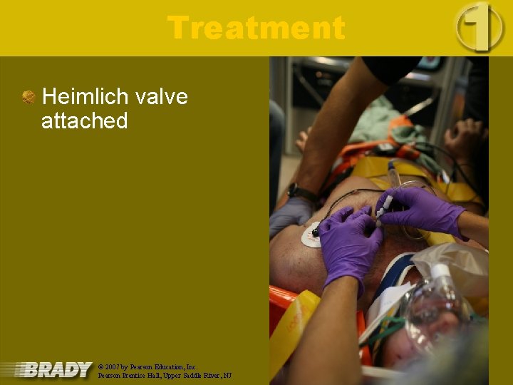 Treatment Heimlich valve attached © 2007 by Pearson Education, Inc. Pearson Prentice Hall, Upper