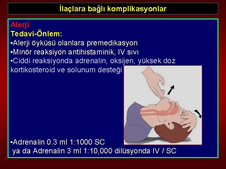 İlaçlara bağlı komplikasyonlar Alerji Tedavi-Önlem: • Alerji öyküsü olanlara premedikasyon • Minör reaksiyon antihistaminik,