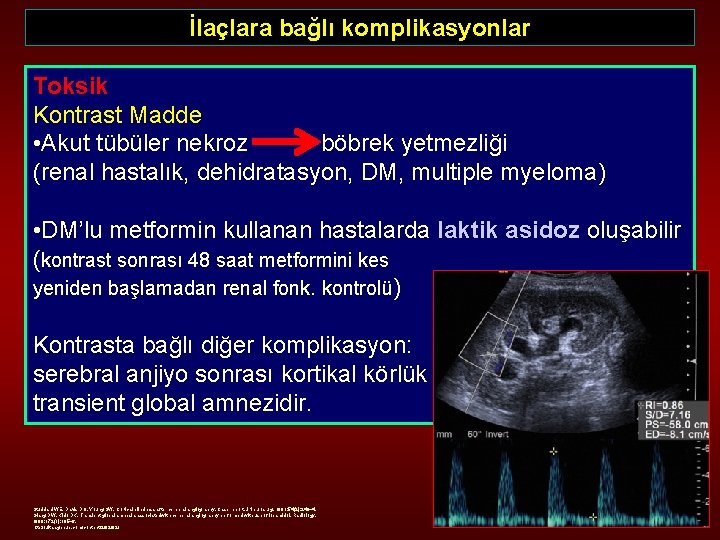 İlaçlara bağlı komplikasyonlar Toksik Kontrast Madde • Akut tübüler nekroz böbrek yetmezliği (renal hastalık,