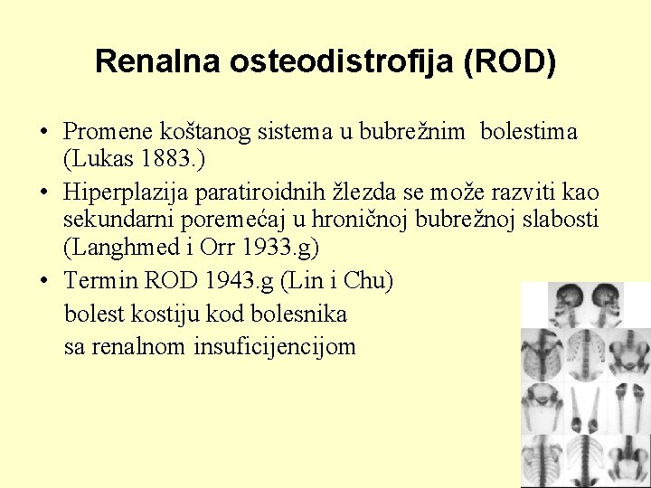 Renalna osteodistrofija (ROD) • Promene koštanog sistema u bubrežnim bolestima (Lukas 1883. ) •