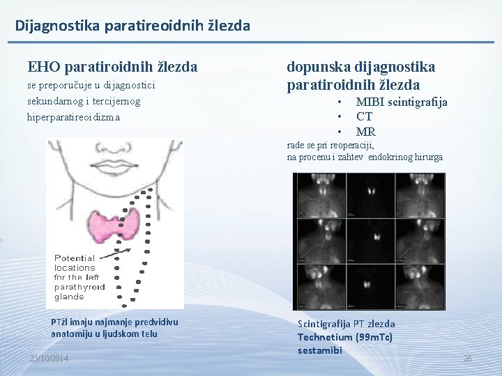 Dijagnostika paratireoidnih žlezda EHO paratiroidnih žlezda se preporučuje u dijagnostici sekundarnog i tercijernog hiperparatireoidizma