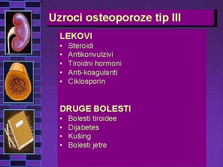 Uzroci osteoporoze tip III LEKOVI • • • Steroidi Antikonvulzivi Tiroidni hormoni Anti-koagulanti Ciklosporin
