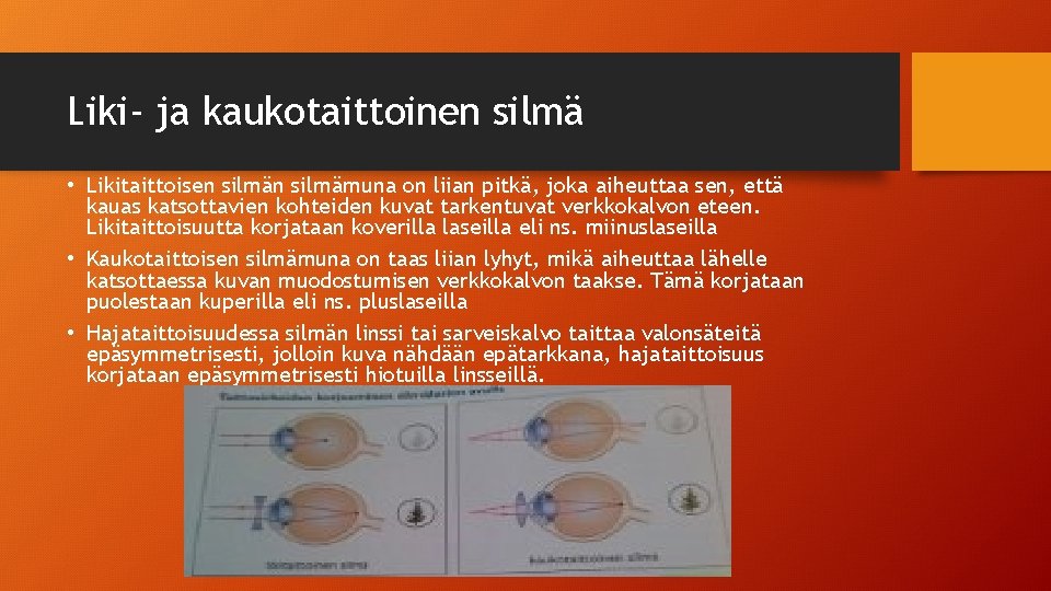 Liki- ja kaukotaittoinen silmä • Likitaittoisen silmämuna on liian pitkä, joka aiheuttaa sen, että