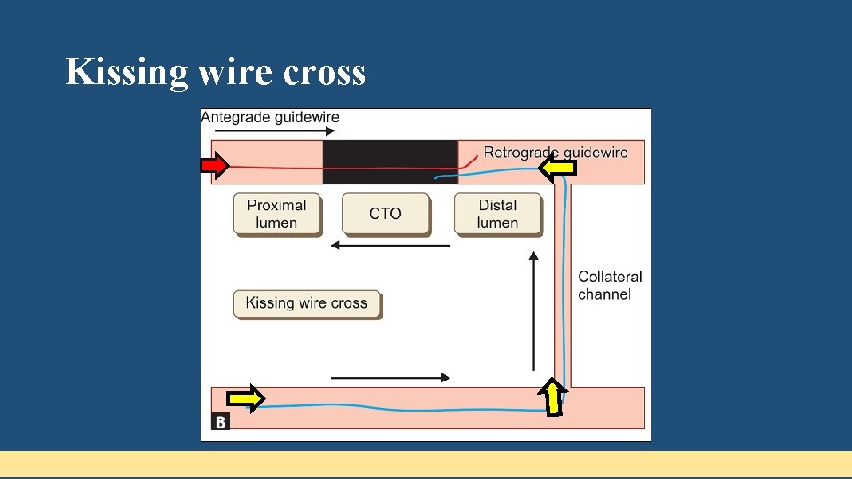 Kissing wire cross 