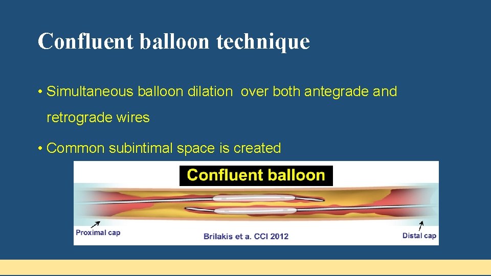 Confluent balloon technique • Simultaneous balloon dilation over both antegrade and retrograde wires •