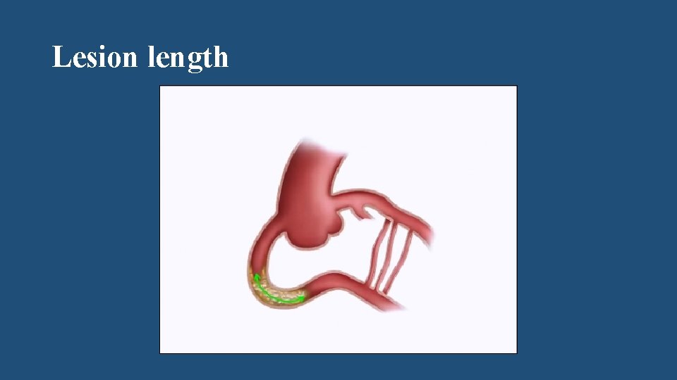 Lesion length 