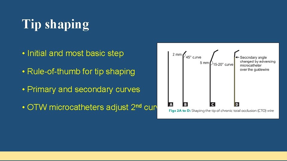 Tip shaping • Initial and most basic step • Rule-of-thumb for tip shaping •