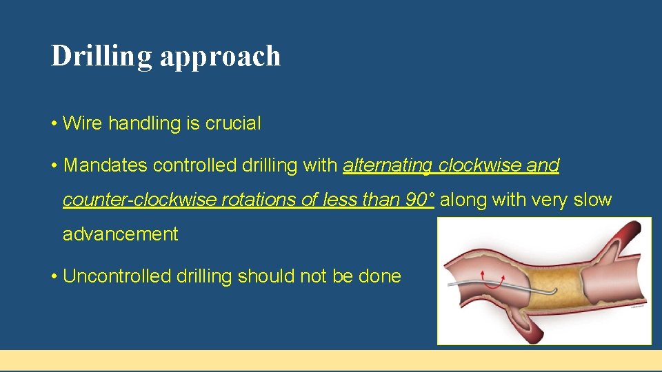 Drilling approach • Wire handling is crucial • Mandates controlled drilling with alternating clockwise