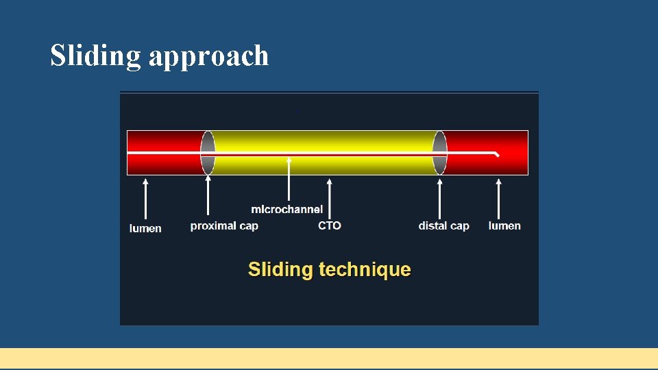 Sliding approach 