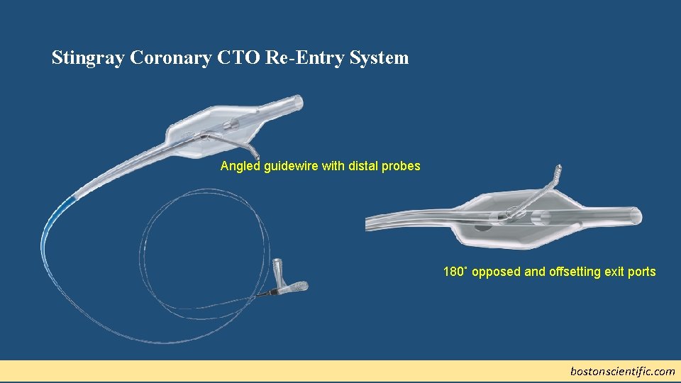 Stingray Coronary CTO Re-Entry System Angled guidewire with distal probes 180˚ opposed and offsetting