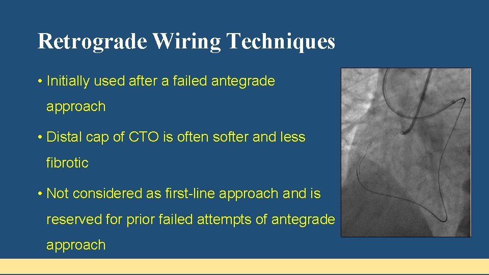 Retrograde Wiring Techniques • Initially used after a failed antegrade approach • Distal cap