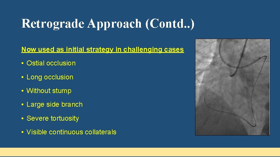 Retrograde Approach (Contd. . ) Now used as initial strategy in challenging cases •