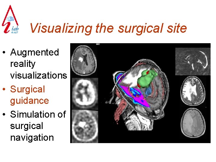 Visualizing the surgical site • Augmented reality visualizations • Surgical guidance • Simulation of