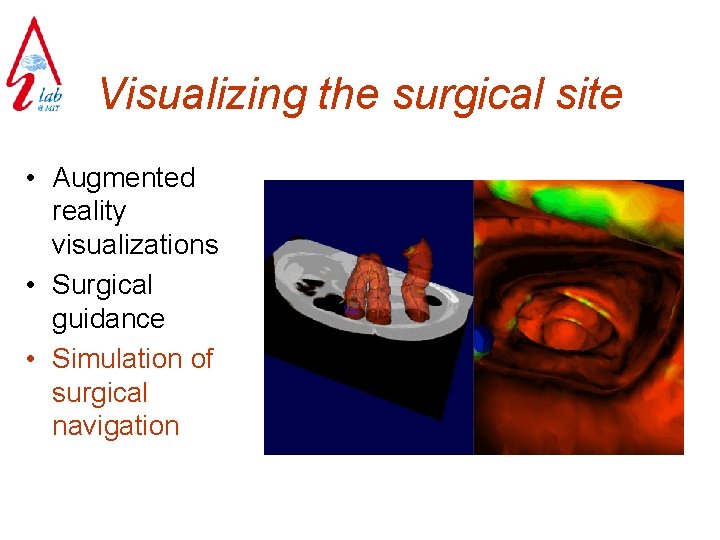 Visualizing the surgical site • Augmented reality visualizations • Surgical guidance • Simulation of