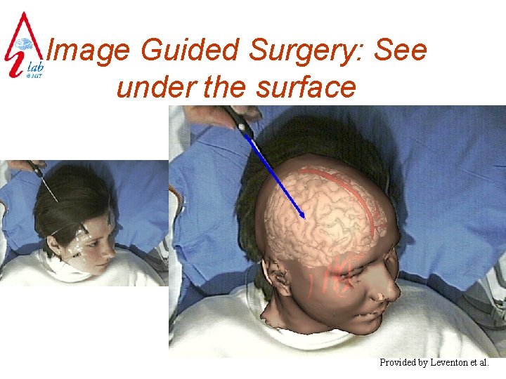 Image Guided Surgery: See under the surface Provided by Leventon et al. 