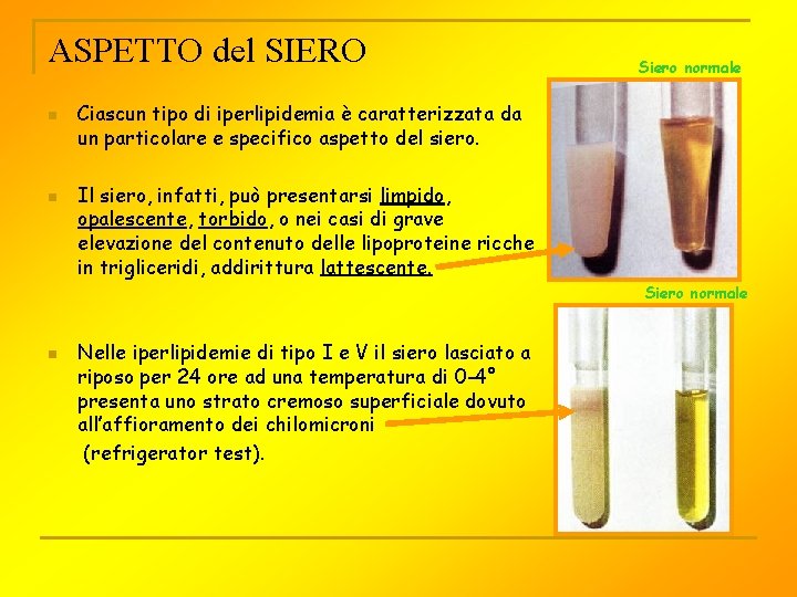 ASPETTO del SIERO n n Siero normale Ciascun tipo di iperlipidemia è caratterizzata da