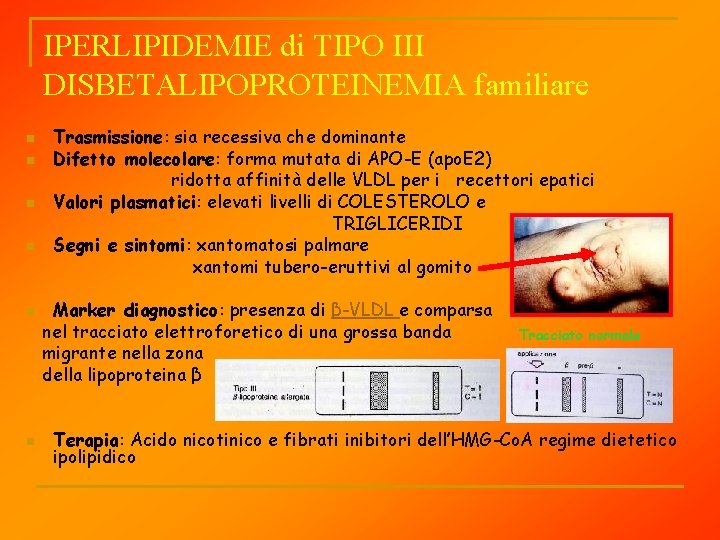 IPERLIPIDEMIE di TIPO III DISBETALIPOPROTEINEMIA familiare n n n Trasmissione: sia recessiva che dominante