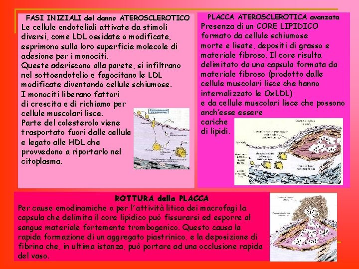 FASI INIZIALI del danno ATEROSCLEROTICO Le cellule endoteliali attivate da stimoli diversi, come LDL