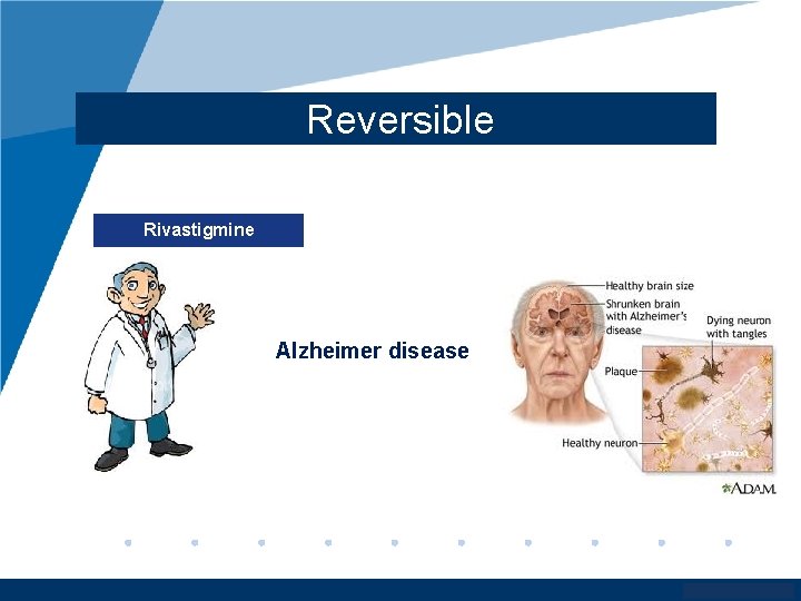 Reversible Rivastigmine Alzheimer disease www. company. com 