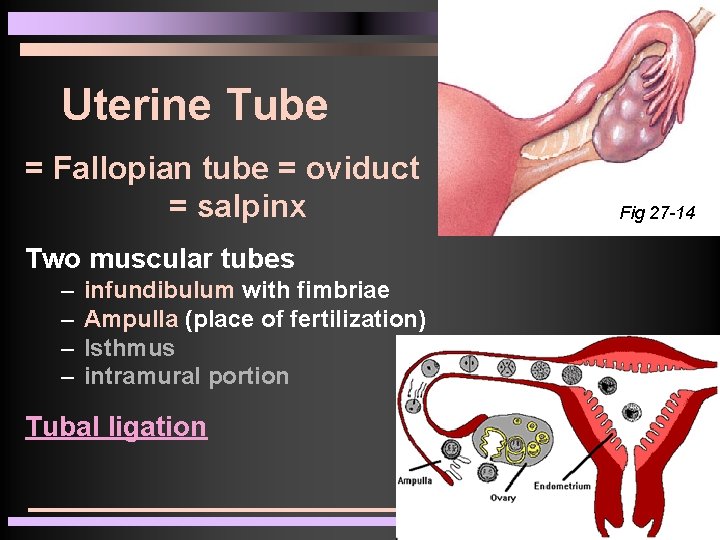 Salping Ch 27 Female Reproductive System All organs are