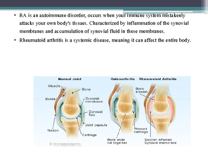  • RA is an autoimmune disorder, occurs when your immune system mistakenly attacks