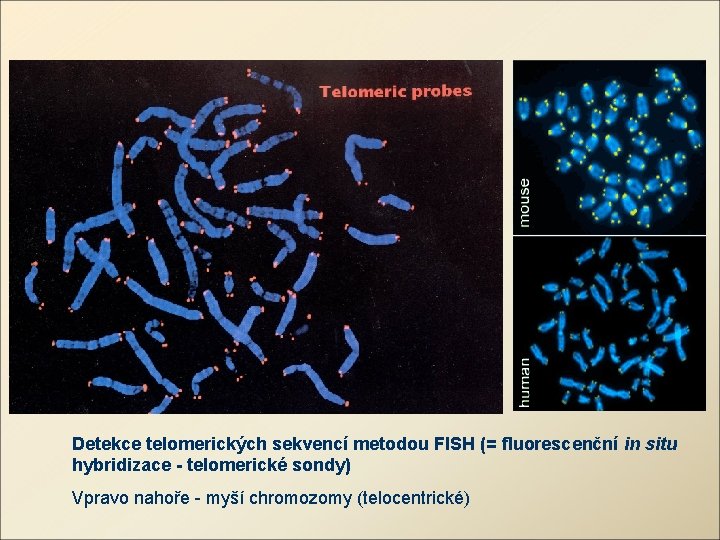 Detekce telomerických sekvencí metodou FISH (= fluorescenční in situ hybridizace - telomerické sondy) Vpravo