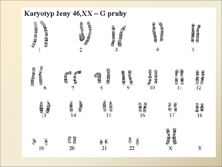 Karyotyp ženy 46, XX – G pruhy 