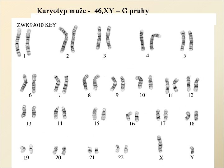 Karyotyp muže - 46, XY – G pruhy 