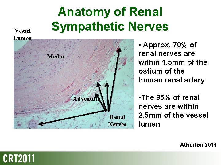 Vessel Lumen Anatomy of Renal Sympathetic Nerves • Approx. 70% of renal nerves are