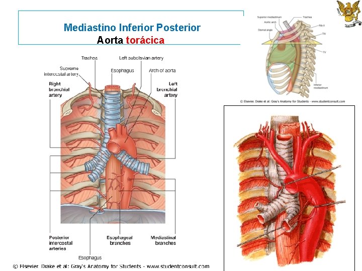 Mediastino Inferior Posterior Aorta torácica 