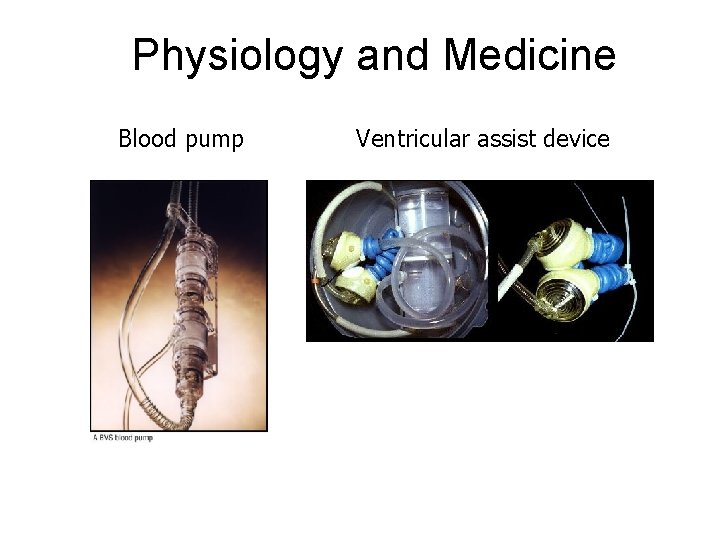 Physiology and Medicine Blood pump Ventricular assist device Physiology and Medicine Blood pump Ventricular assist device