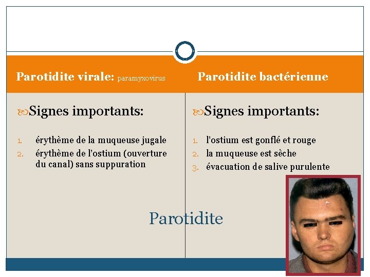 Parotidite virale: paramyxovirus Signes importants: 1. 2. Parotidite bactérienne Signes importants: érythème de la