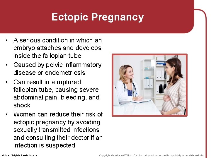 Ectopic Pregnancy • A serious condition in which an embryo attaches and develops inside