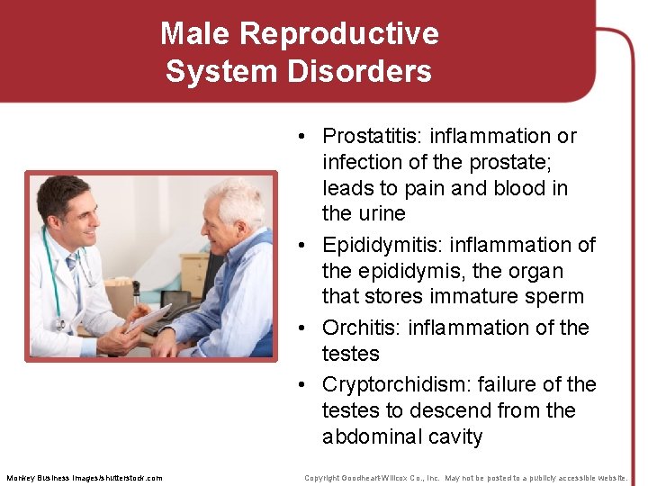 Male Reproductive System Disorders • Prostatitis: inflammation or infection of the prostate; leads to